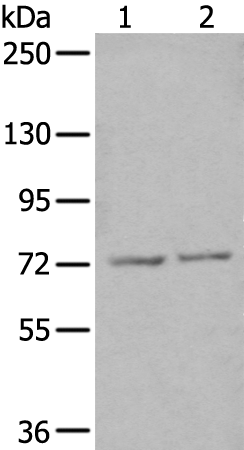 Gel: 6%SDS-PAGE Lysate: 40 microg Lane 1-2: Jurkat and PC-3 cell lysates Primary antibody: TA367764 (ZNF7 Antibody) at dilution 1/200 Secondary antibody: Goat anti rabbit IgG at 1/8000 dilution Exposure time: 2 minutes