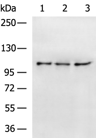 Gel: 6%SDS-PAGE Lysate: 40 microg Lane 1-3: Hela Jurkat A549 cell lysates Primary antibody: TA367792 (XYLT1 Antibody) at dilution 1/700 Secondary antibody: Goat anti rabbit IgG at 1/5000 dilution Exposure time: 2 minutes