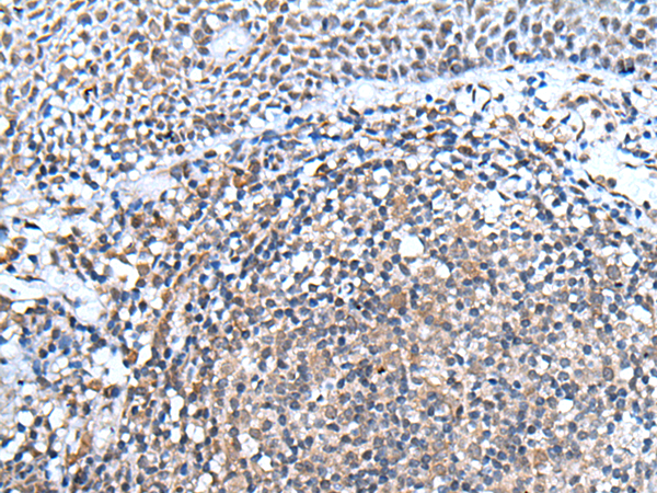 Immunohistochemistry of paraffin-embedded Human tonsil tissue using TA367840 (URB1 Antibody) at dilution 1/30 (Original magnification: x200)
