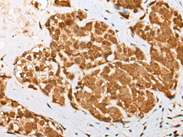 Anti-EFNA2 mouse monoclonal antibody (TA501461) immunofluorescent staining of COS7 cells transiently transfected by pCMV6-ENTRY EFNA2 (RC213728).