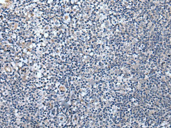 Immunohistochemistry of paraffin-embedded Human tonsil tissue using TA367861 (SPTB Antibody) at dilution 1/40 (Original magnification: x200)