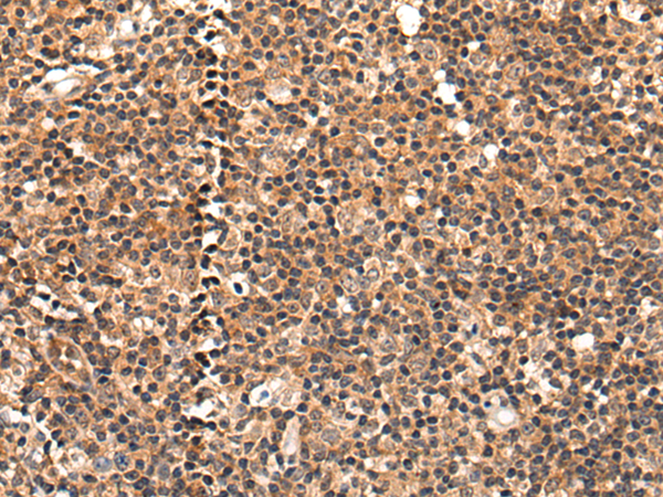 Immunohistochemistry of paraffin-embedded Human tonsil tissue using TA367903 (BMERB1 Antibody) at dilution 1/45 (Original magnification: x200)