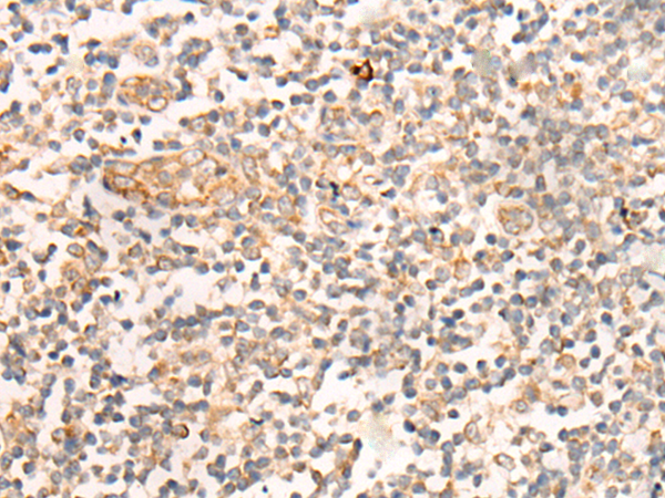 Immunohistochemistry of paraffin-embedded Human tonsil tissue using TA367940 (CASS4 Antibody) at dilution 1/35 (Original magnification: x200)