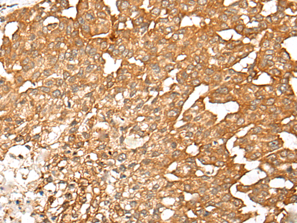 HEK293T cells were transfected with the pCMV6-ENTRY control (Left lane) or pCMV6-ENTRY NT5DC1 (RC211087, Right lane) cDNA for 48 hrs and lysed. Equivalent amounts of cell lysates (5 ug per lane) were separated by SDS-PAGE and immunoblotted with anti-NT5DC1. Positive lysates LY403486 (100 ug) and LC403486 (20 ug) can be purchased separately from OriGene.