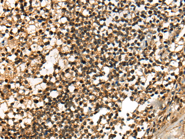 Immunohistochemistry of paraffin-embedded Human tonsil tissue using TA367981 (ODF2 Antibody) at dilution 1/40 (Original magnification: x200)