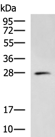 Gel: 12%SDS-PAGE Lysate: 40 microg Lane: Mouse lung tissue lysate Primary antibody: TA367986 (HAUS2 Antibody) at dilution 1/300 Secondary antibody: Goat anti rabbit IgG at 1/5000 dilution Exposure time: 2 minutes