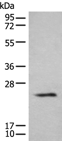 Gel: 12%SDS-PAGE Lysate: 40 microg Lane: Human cerebrum tissue lysate Primary antibody: TA368007 (BHLHA9 Antibody) at dilution 1/200 Secondary antibody: Goat anti rabbit IgG at 1/8000 dilution Exposure time: 40 seconds