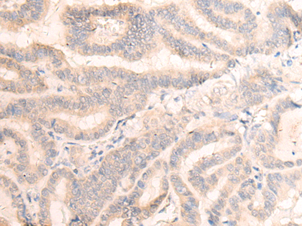 HEK293T cells were transfected with the pCMV6-ENTRY control (Left lane) or pCMV6-ENTRY SPR (RC205679, Right lane) cDNA for 48 hrs and lysed. Equivalent amounts of cell lysates (5 ug per lane) were separated by SDS-PAGE and immunoblotted with anti-SPR. Positive lysates LY401086 (100 ug) and LC401086 (20 ug) can be purchased separately from OriGene.