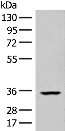 Gel: 8%SDS-PAGE Lysate: 40 microg Lane: Human heart tissue lysate Primary antibody: TA368314 (FBXO16 Antibody) at dilution 1/400 Secondary antibody: Goat anti rabbit IgG at 1/8000 dilution Exposure time: 20 seconds