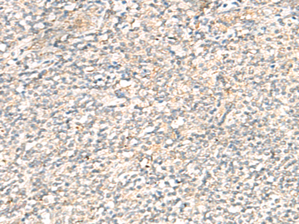 Immunohistochemistry of paraffin-embedded Human tonsil tissue using TA368333 (TACO1 Antibody) at dilution 1/25 (Original magnification: x200)