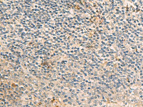 Immunohistochemistry of paraffin-embedded Human tonsil tissue using TA368342 (FRAT1 Antibody) at dilution 1/20 (Original magnification: x200)