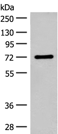 Gel: 8%SDS-PAGE Lysate: 40 microg Lane: Rat brain tissue lysate Primary antibody: TA368348 (SLC6A11 Antibody) at dilution 1/500 Secondary antibody: Goat anti rabbit IgG at 1/8000 dilution Exposure time: 40 seconds