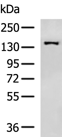 Gel: 6%SDS-PAGE Lysate: 40 microg Lane: HepG2 cell lysate Primary antibody: TA368384 (GOLGA3 Antibody) at dilution 1/500 Secondary antibody: Goat anti rabbit IgG at 1/5000 dilution Exposure time: 1 minute