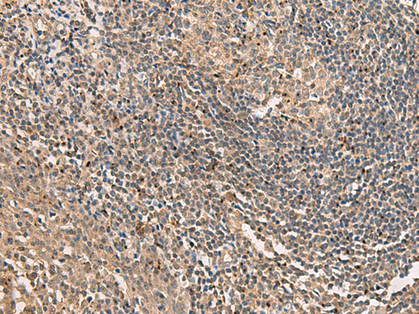 Anti-SQSTM1 mouse monoclonal antibody (TA502131) immunofluorescent staining of COS7 cells transiently transfected by pCMV6-ENTRY SQSTM1 (RC203214) (1:100).