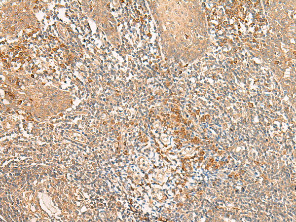 Immunohistochemistry of paraffin-embedded Human tonsil tissue using TA368444 (WLS Antibody) at dilution 1/50 (Original magnification: x200)