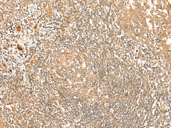 Immunohistochemistry of paraffin-embedded Human tonsil tissue using TA368446 (PROKR1 Antibody) at dilution 1/40 (Original magnification: x200)