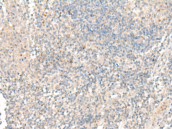 Immunohistochemistry of paraffin-embedded Human tonsil tissue using TA368449 (GPRC5C Antibody) at dilution 1/30 (Original magnification: x200)