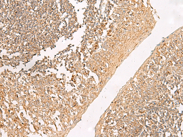 Immunohistochemistry of paraffin-embedded Human tonsil tissue using TA368460 (GRIK5 Antibody) at dilution 1/35 (Original magnification: x200)
