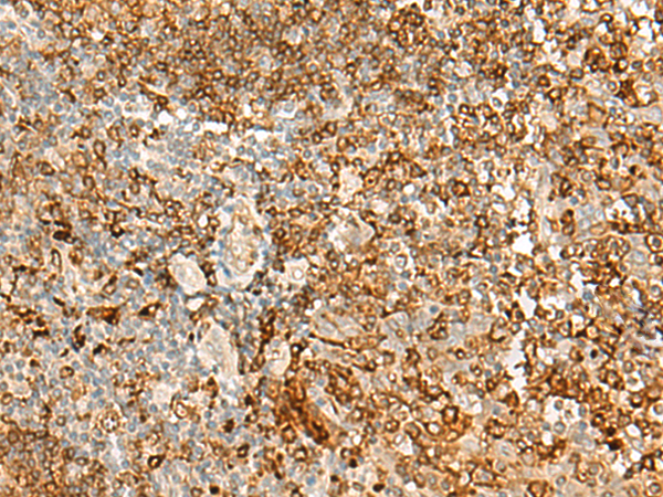 Immunohistochemistry of paraffin-embedded Human tonsil tissue using TA368501 (HLA-DRB1 Antibody) at dilution 1/35 (Original magnification: x200)
