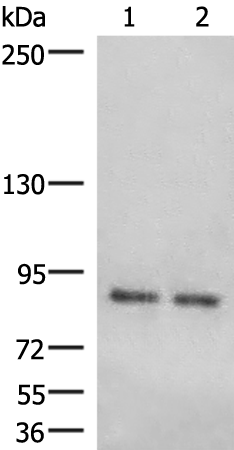 Gel: 6%SDS-PAGE Lysate: 40 microg Lane 1-2: Human cerebrum tissue Human cerebella tissue lysates Primary antibody: TA368513 (HOOK3 Antibody) at dilution 1/300 Secondary antibody: Goat anti rabbit IgG at 1/8000 dilution Exposure time: 1 minute