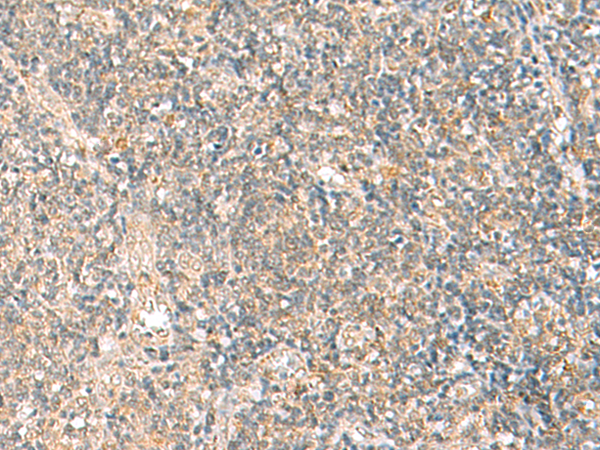 Immunohistochemistry of paraffin-embedded Human tonsil tissue using TA368519 (HPDL Antibody) at dilution 1/20 (Original magnification: x200)