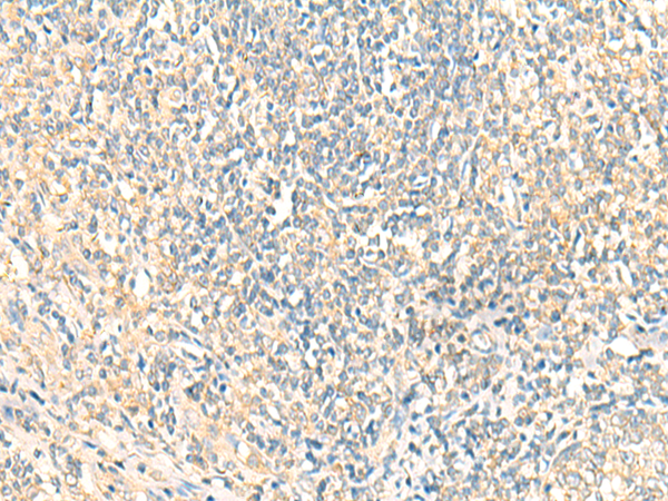 Immunohistochemistry of paraffin-embedded Human tonsil tissue using TA368532 (MTIF2 Antibody) at dilution 1/20 (Original magnification: x200)