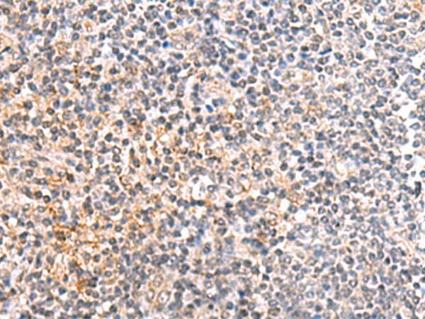 Immunohistochemistry of paraffin-embedded Human tonsil tissue using TA368542 (IL36B Antibody) at dilution 1/30 (Original magnification: x200)