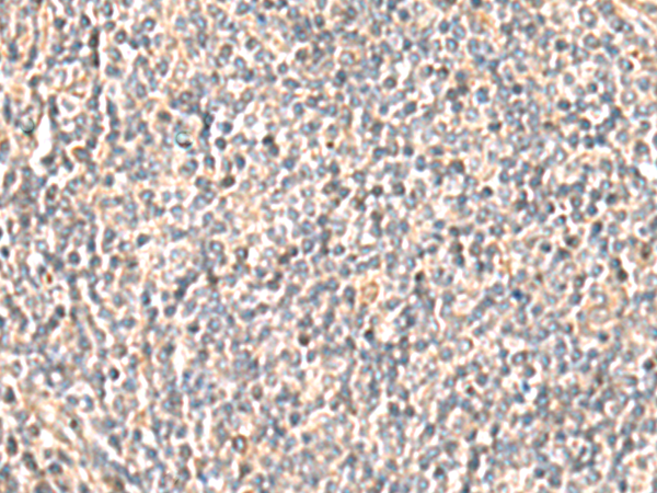 Immunohistochemistry of paraffin-embedded Human tonsil tissue using TA368549 (OCRL Antibody) at dilution 1/30 (Original magnification: x200)
