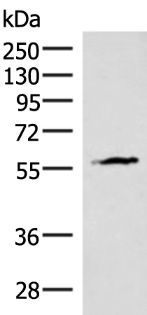 Gel: 8%SDS-PAGE Lysate: 40 microg Lane: Mouse heart tissue lysate Primary antibody: TA368552 (INSM2 Antibody) at dilution 1/400 Secondary antibody: Goat anti rabbit IgG at 1/8000 dilution Exposure time: 1 minute