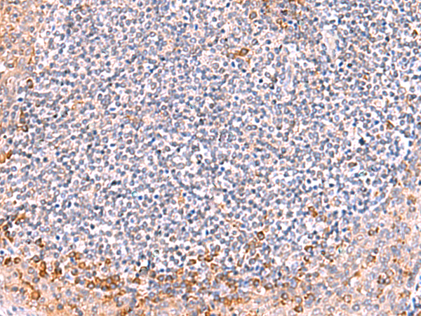 Immunohistochemistry of paraffin-embedded Human tonsil tissue using TA368556 (ITSN2 Antibody) at dilution 1/40 (Original magnification: x200)