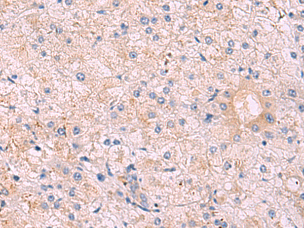 Immunohistochemistry of paraffin-embedded Human tonsil tissue using TA368595 (KANSL1L Antibody) at dilution 1/40 (Original magnification: x200)