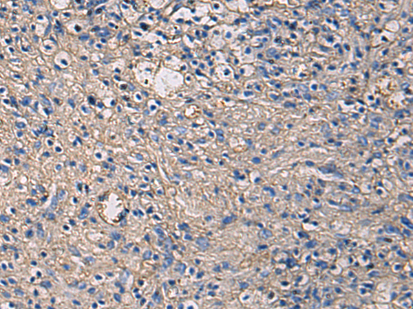 Immunohistochemistry of paraffin-embedded Human brain using TA368626 (IGHG1 Antibody) at dilution 1/60 (Original magnification: x200)