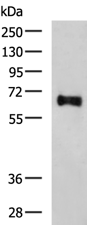 Gel: 8%SDS-PAGE Lysate: 40 microg Lane: Mouse brain tissue lysate Primary antibody: TA368705 (SLC24A4 Antibody) at dilution 1/400 Secondary antibody: Goat anti rabbit IgG at 1/5000 dilution Exposure time: 3 minutes