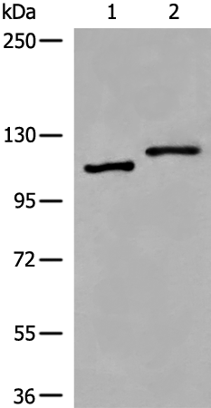 Gel: 6%SDS-PAGE Lysate: 40 microg Lane 1-2: Hela and K562 cell lysates Primary antibody: TA368894 (VPS18 Antibody) at dilution 1/400 Secondary antibody: Goat anti rabbit IgG at 1/8000 dilution Exposure time: 50 seconds