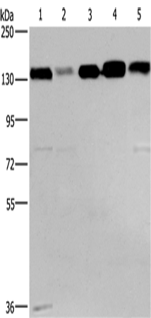 Gel: 6%SDS-PAGE Lysate: 40 microg Lane 1-5: 293T cells hela cells PC3 cells lovo cells A172 cells Primary antibody: TA369038 (CEP97 Antibody) at dilution 1/500 Secondary antibody: Goat anti rabbit IgG at 1/8000 dilution Exposure time: 30 seconds
