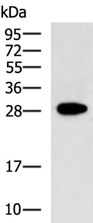 Gel: 12%SDS-PAGE Lysate: 40 microg Lane: Human uterus tissue lysate Primary antibody: TA369126 (FGF14 Antibody) at dilution 1/800 Secondary antibody: Goat anti rabbit IgG at 1/5000 dilution Exposure time: 5 minutes