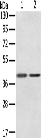 Gel: 8%SDS-PAGE Lysate: 40 microg Lane 1-2: Raw264.7 TM4 cells Primary antibody: TA369385 (STX18 Antibody) at dilution 1/350 Secondary antibody: Goat anti rabbit IgG at 1/8000 dilution Exposure time: 20 seconds