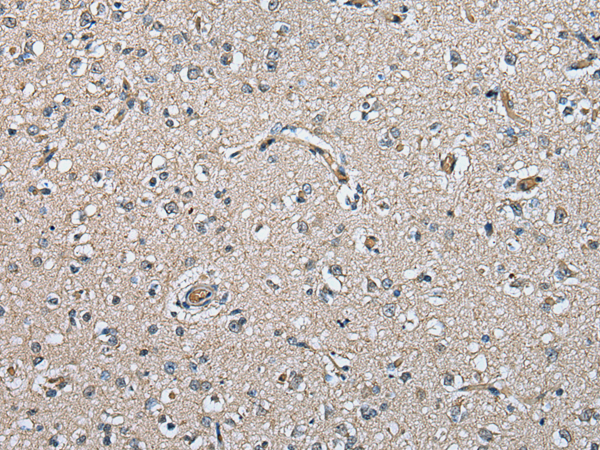 Immunohistochemistry of paraffin-embedded Human brain tissue using TA369561 (PRSS38 Antibody) at dilution 1/20 (Original magnification: x200)