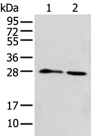 Gel: 12%SDS-PAGE Lysate: 40 microg Lane 1-2: K562 cell and A431 cell Primary antibody: TA369626 (DENR Antibody) at dilution 1/250 Secondary antibody: Goat anti rabbit IgG at 1/8000 dilution Exposure time: 30 seconds