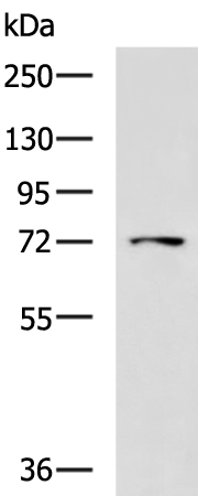 Gel: 8%SDS-PAGE Lysate: 40 microg Lane: HepG2 cell lysate Primary antibody: TA369663 (LRRC45 Antibody) at dilution 1/1000 Secondary antibody: Goat anti rabbit IgG at 1/5000 dilution Exposure time: 2 minutes