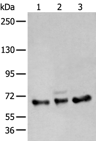 Gel: 6%SDS-PAGE Lysate: 40 microg Lane 1-3: A431 K562 and TM4 cell lysates Primary antibody: TA369690 (ZBTB5 Antibody) at dilution 1/400 Secondary antibody: Goat anti rabbit IgG at 1/8000 dilution Exposure time: 20 seconds