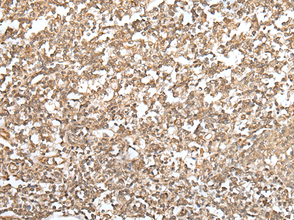 Immunohistochemistry of paraffin-embedded Human tonsil tissue using TA369699 (ZNF19 Antibody) at dilution 1/30 (Original magnification: x200)