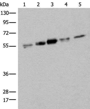 Gel: 8%SDS-PAGE Lysate: 40 microg Lane 1-5: Hela HEPG2 231 A431 and Jurkat cell lysates Primary antibody: TA369705 (ZPR1 Antibody) at dilution 1/400 Secondary antibody: Goat anti rabbit IgG at 1/8000 dilution Exposure time: 20 seconds