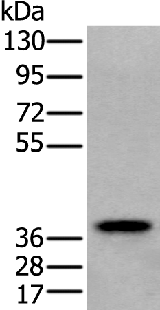 Gel: 8%SDS-PAGE Lysate: 40 microg Lane: Human testis tissue lysate Primary antibody: TA369725 (ZPBP Antibody) at dilution 1/250 Secondary antibody: Goat anti rabbit IgG at 1/8000 dilution Exposure time: 20 seconds