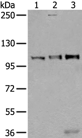 Gel: 6%SDS-PAGE Lysate: 40 microg Lane 1-3: Mouse testis tissue Jurkat and A549 cell lysates Primary antibody: TA369756 (USO1 Antibody) at dilution 1/350 Secondary antibody: Goat anti rabbit IgG at 1/8000 dilution Exposure time: 30 seconds