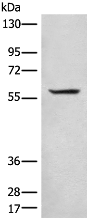 Gel: 8%SDS-PAGE Lysate: 40 microg Lane: PC-3 cell lysate Primary antibody: TA369914 (CCDC102B Antibody) at dilution 1/200 Secondary antibody: Goat anti rabbit IgG at 1/8000 dilution Exposure time: 5 seconds