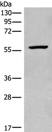 Gel: 8%SDS-PAGE Lysate: 40 microg Lane: Mouse heart tissue lysate Primary antibody: TA369932 (CDADC1 Antibody) at dilution 1/450 Secondary antibody: Goat anti rabbit IgG at 1/8000 dilution Exposure time: 20 seconds