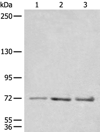 Gel: 6%SDS-PAGE Lysate: 40 microg Lane 1-3: TM4 NIH/3T3 and Jurkat cell lysates Primary antibody: TA369953 (CEP72 Antibody) at dilution 1/600 Secondary antibody: Goat anti rabbit IgG at 1/8000 dilution Exposure time: 1 minute