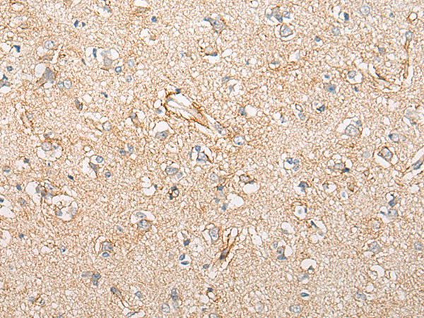 Immunohistochemistry of paraffin-embedded Human brain tissue using TA369980 (CIAO1 Antibody) at dilution 1/25 (Original magnification: x200)