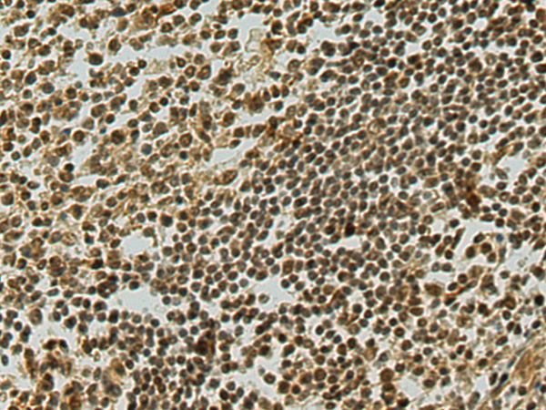 Immunohistochemistry of paraffin-embedded Human tonsil tissue using TA370028 (MIER1 Antibody) at dilution 1/80 (Original magnification: x200)
